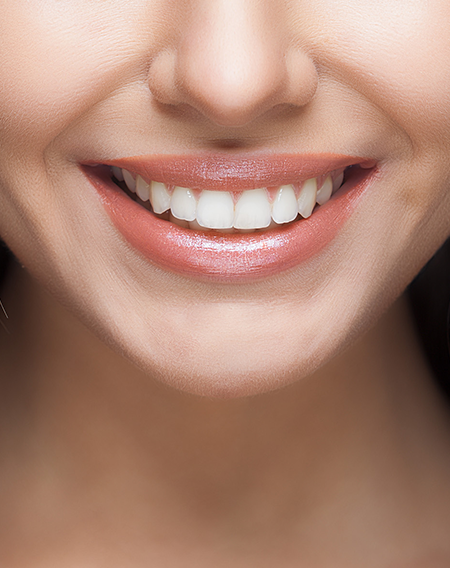 Gülüş Tasarımı, Smile Design